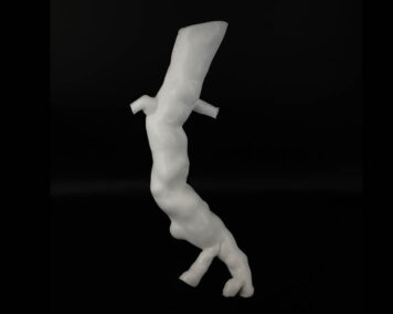 aorte-impression-3d-silicone