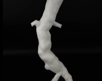 aorte-3d-print